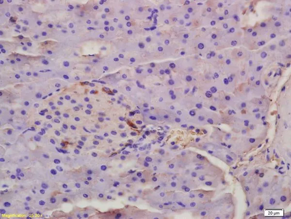 IHC-P analysis of rat placenta tissue using GTX04731 EDA antibody. Dilution : 1:200 IHC-P analysis of rat placenta tissue using GTX04731 EDA antibody. Dilution : 1:200