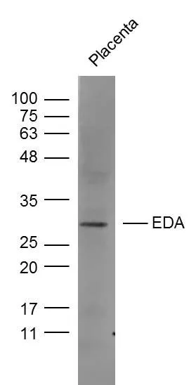WB analysis of mouse placenta tissue lysate using GTX04731 EDA antibody. Dilution : 1:300