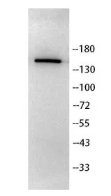 WB analysis of SH-SY5Y whole cell lysate using GTX04734 YSK4 antibody. Dilution : 1:2000 WB analysis of SH-SY5Y whole cell lysate using GTX04734 YSK4 antibody. Dilution : 1:2000