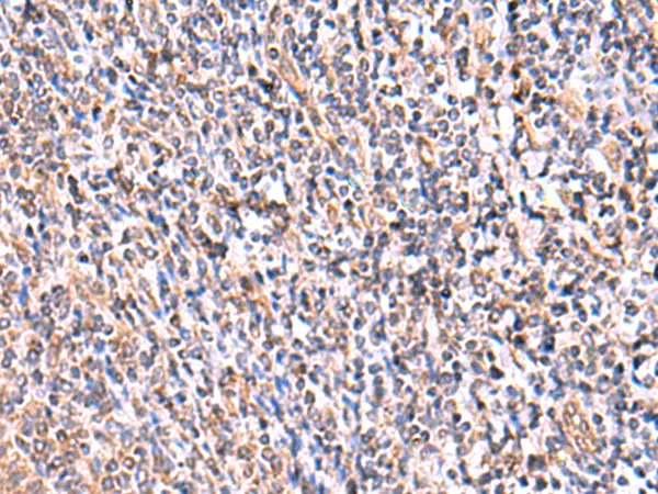IHC-P analysis of human tonsil tissue using GTX04750 UXS1 antibody. Dilution : 1:60 IHC-P analysis of human tonsil tissue using GTX04750 UXS1 antibody. Dilution : 1:60