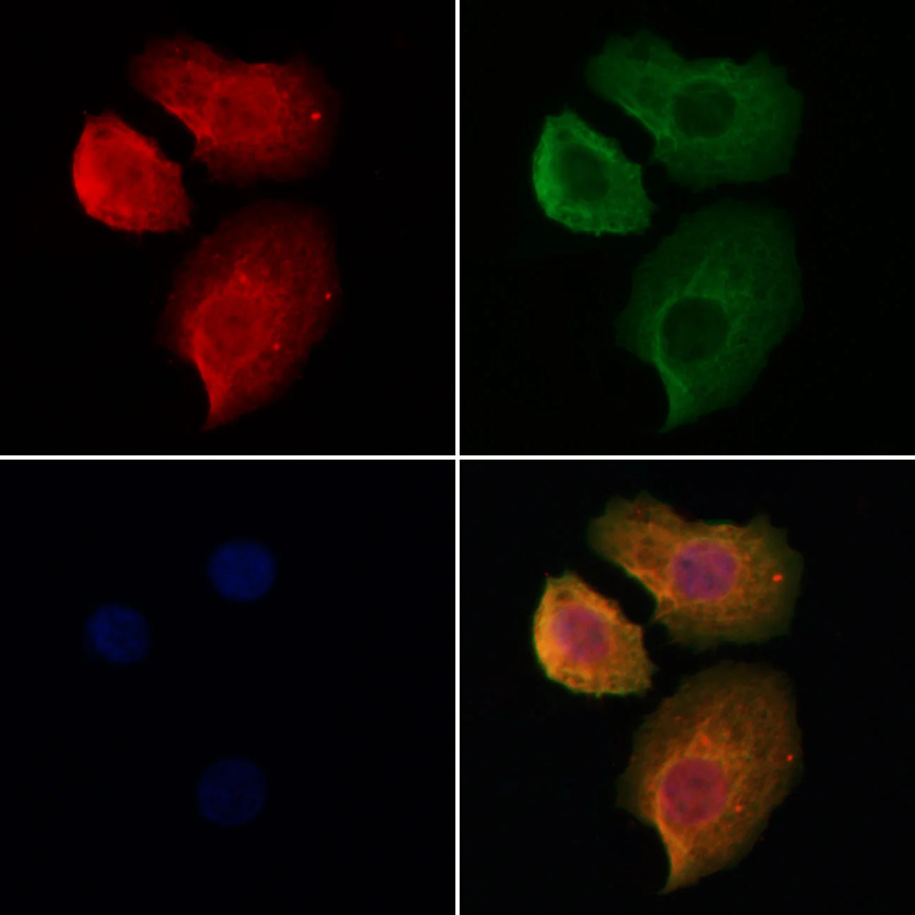 ICC/IF analysis of PFA-fixed HeLa cells using GTX04751 Hemoglobin alpha antibody. Red : Primary antibody Green : Beta tubulin Blue : DAPI Permeabilization : 0.1% Triton X-100 Dilution : 1:200 ICC/IF analysis of PFA-fixed HeLa cells using GTX04751 Hemoglobin alpha antibody. Red : Primary antibody Green : Beta tubulin Blue : DAPI Permeabilization : 0.1% Triton X-100 Dilution : 1:200