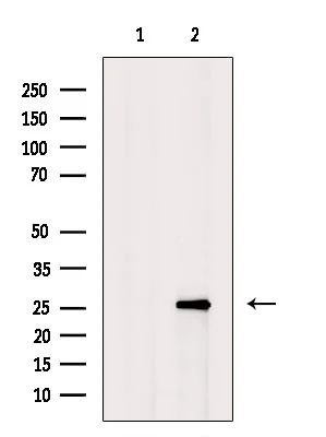 WB analysis of A2780 whole cell lysate using GTX04751 Hemoglobin alpha antibody. The lane on the left was treated with blocking peptide.