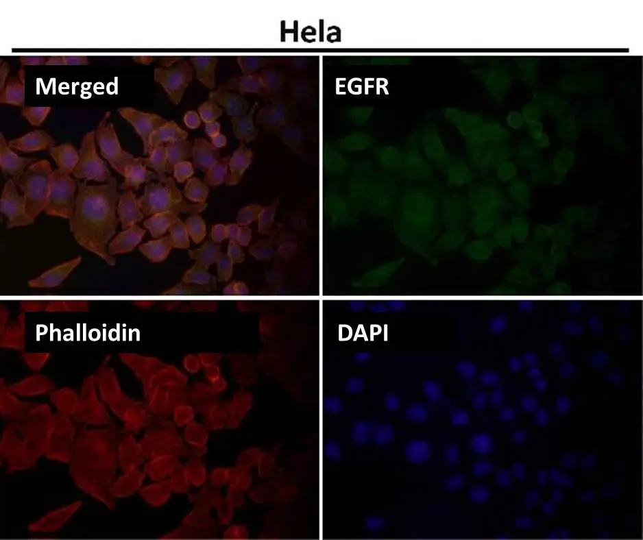ICC/IF analysis of HeLa cells using GTX04753 EGFR antibody [AEF-5]. Dilution : 1:150