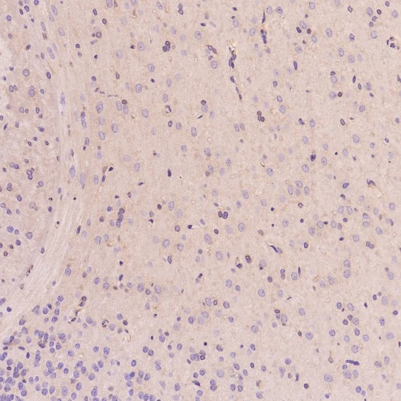 IHC-P analysis of rat cerebral cortex tissue using GTX04753 EGFR antibody [AEF-5]. Dilution : 1:100