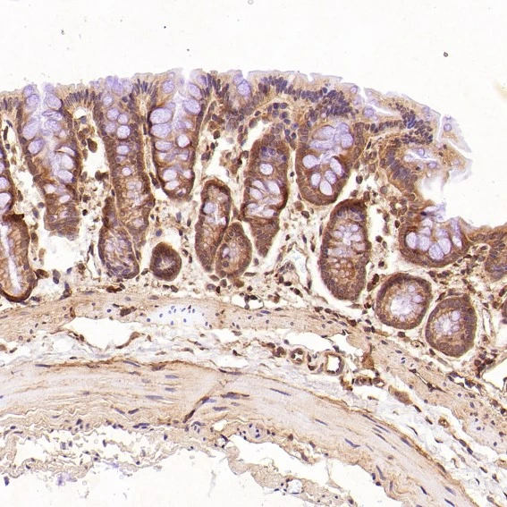 IHC-P analysis of rat stomach tissue using GTX04753 EGFR antibody [AEF-5]. Dilution : 1:100