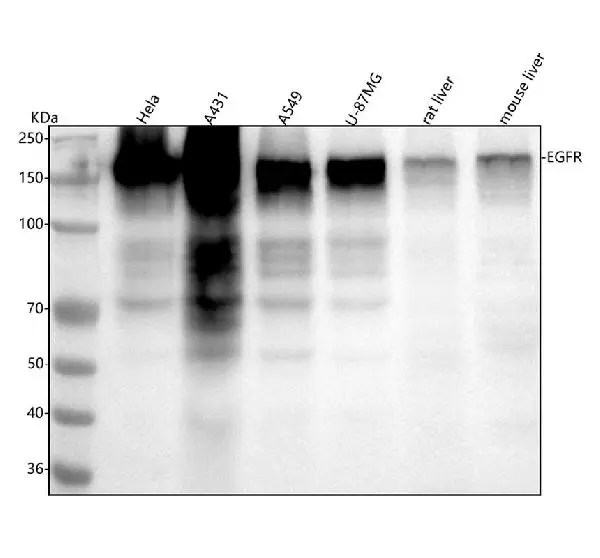 WB analysis of various samples using GTX04753 EGFR antibody [AEF-5]. Loading : 30 microg Dilution : 1:5000
