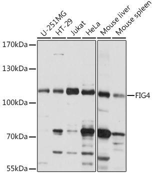 WB analysis of various samples using GTX04755 FIG4 antibody. Loading : 25 microg Dilution : 1:1000 WB analysis of various samples using GTX04755 FIG4 antibody. Loading : 25 microg Dilution : 1:1000