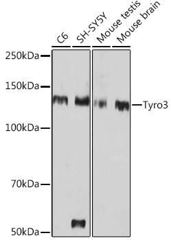 WB analysis of various samples using GTX04756 TYRO3 antibody [ARC1841]. Loading : 25 microg Dilution : 1:1000