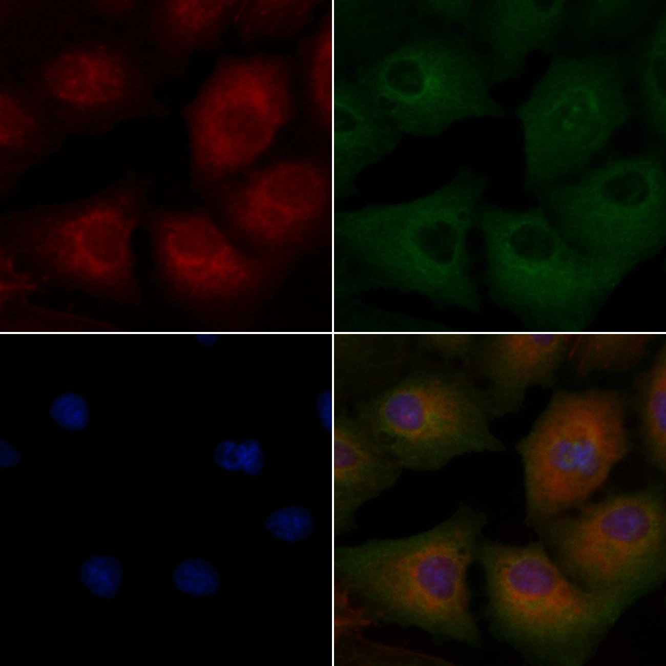 ICC/IF analysis of PFA-fixed A549 cells using GTX04760 Transgelin antibody. Red : Primary antibody Green : Beta tubulin Blue : DAPI Permeabilization : 0.1% Triton X-100 ICC/IF analysis of PFA-fixed A549 cells using GTX04760 Transgelin antibody. Red : Primary antibody Green : Beta tubulin Blue : DAPI Permeabilization : 0.1% Triton X-100