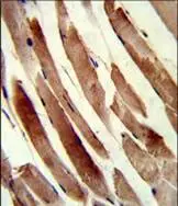 IHC-P analysis of human skeletal muscle tissue using GTX04761 Transgelin antibody.
