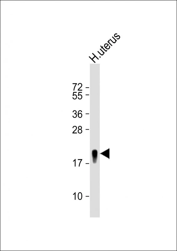 WB analysis of human uterus tissue lysate using GTX04761 Transgelin antibody. Loading : 20 microg Dilution : 1:8000