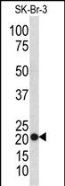 WB analysis of SK-Br-3 whole cell lysate using GTX04761 Transgelin antibody. Loading : 35 microg