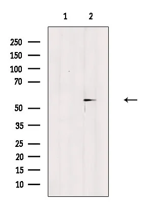 WB analysis of HepG2 cells with heat-shock treatment using GTX04766 Estrogen Receptor beta (phospho Ser87) antibody. The lane on the left was treated with blocking peptide.