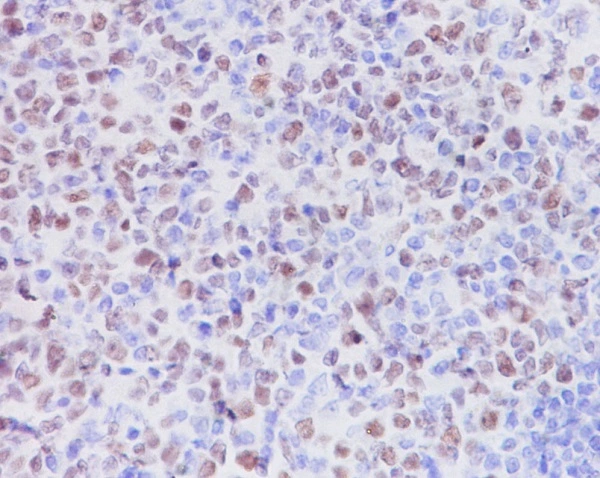 IHC-P analysis of human tonsil tissue using GTX04778 EZH2 antibody [IDF-5].