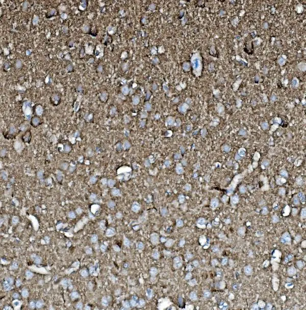 IHC-P analysis of rat brain tissue using GTX04779 GAP43 antibody. Antigen retrieval : Heat mediated EDTA buffer (pH 8.0) Dilution : 1 microg/mL