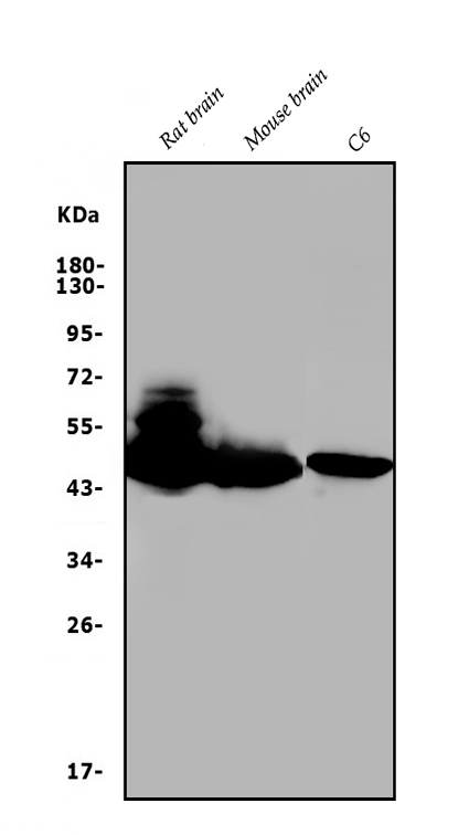 WB analysis of various samples using GTX04779 GAP43 antibody. Loading : 50 microg Dilution : 0.25 microg/mL