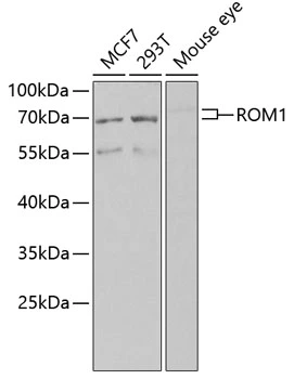 WB analysis of various samples using GTX04780 ROM1 antibody. Loading : 25 microg Dilution : 1:1000