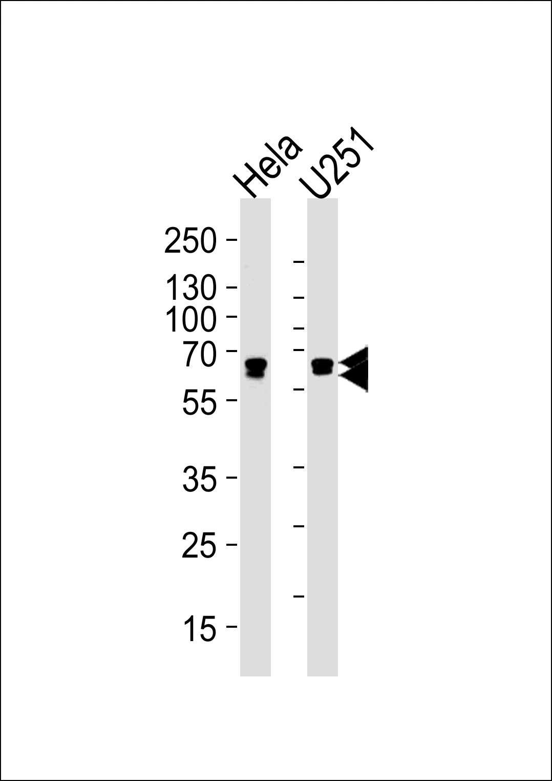 WB analysis of various samples using GTX04792 FUBP3 antibody [1216CT820.155.150]. Loading : 35 microg/mL
