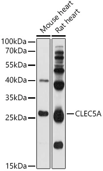 WB analysis of various samples using GTX04797 CLEC5A antibody. Lane 1 : Mouse heart tissue lysate Lane 2 : Rat heart tissue lysate Loading : 25 microg Dilution : 1:1000 WB analysis of various samples using GTX04797 CLEC5A antibody. Lane 1 : Mouse heart tissue lysate Lane 2 : Rat heart tissue lysate Loading : 25 microg Dilution : 1:1000