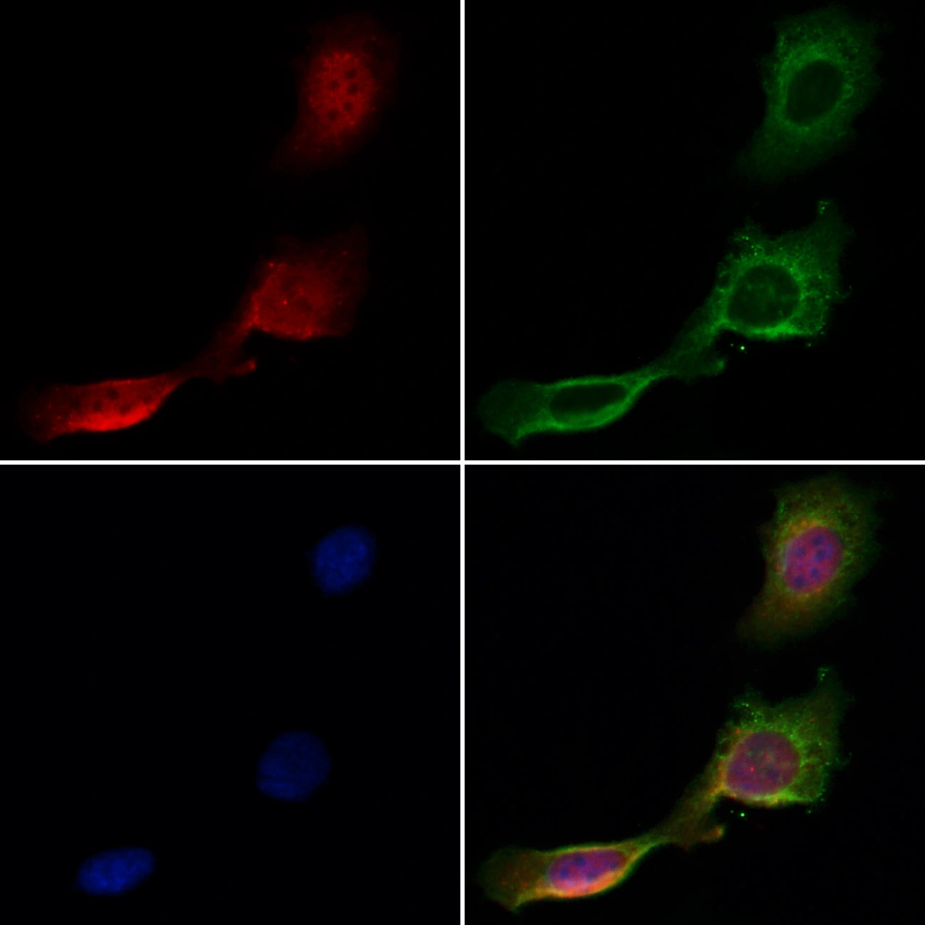 ICC/IF analysis of PFA-fixed HeLa cells using GTX04801 DCP1A antibody. Red : Primary antibody Green : Beta tubulin Blue : DAPI Permeabilization : 0.1% Triton X-100 Dilution : 1:200 ICC/IF analysis of PFA-fixed HeLa cells using GTX04801 DCP1A antibody. Red : Primary antibody Green : Beta tubulin Blue : DAPI Permeabilization : 0.1% Triton X-100 Dilution : 1:200