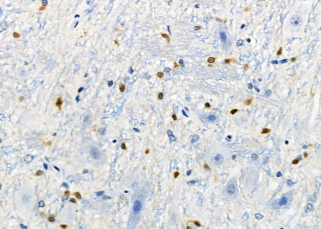 IHC-P analysis of rat brain tissue using GTX04801 DCP1A antibody. Antigen retrieval : Heat mediated citrate buffer Dilution : 1:100