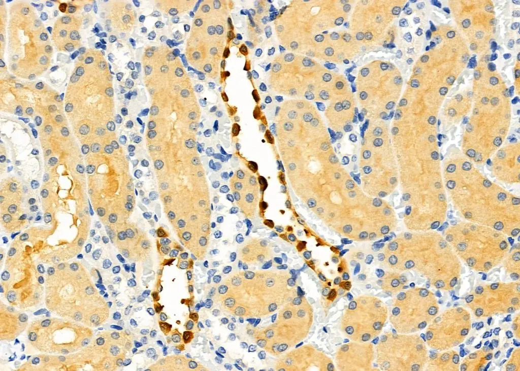 IHC-P analysis of rat kidney tissue using GTX04801 DCP1A antibody. Antigen retrieval : Heat mediated citrate buffer Dilution : 1:100
