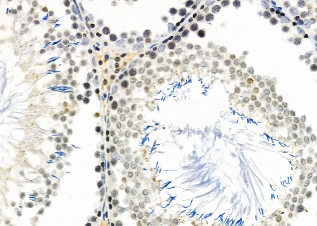 IHC-P analysis of rat testis tissue using GTX04801 DCP1A antibody. Antigen retrieval : Heat mediated citrate buffer Dilution : 1:100