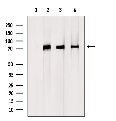 WB analysis of various samples using GTX04801 DCP1A antibody. Lane 1 : MCF-7 whole cell lysate treated with blocking peptide Lane 2 : MCF-7 whole cell lysate Lane 3 : Mouse brain tissue lysate Lane 4 : C6 whole cell lysate