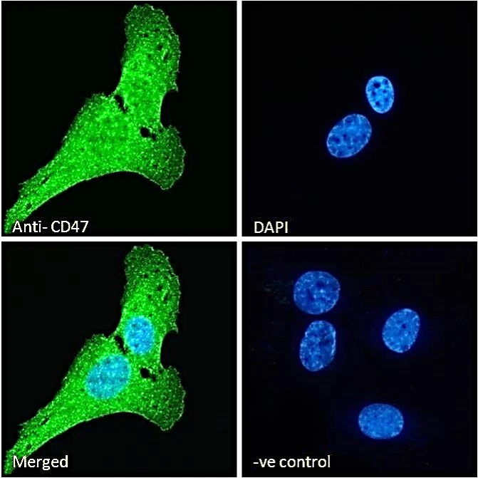 ICC/IF analysis of PFA-fixed U2OS cells using GTX04816 CD47 antibody. Green : Primary antibody Blue : DAPI Ve-control : Unimmunized goat IgG Permeabilization : 0.15% Triton X-100 Dilution : 10 microg/ml ICC/IF analysis of PFA-fixed U2OS cells using GTX04816 CD47 antibody. Green : Primary antibody Blue : DAPI Ve-control : Unimmunized goat IgG Permeabilization : 0.15% Triton X-100 Dilution : 10 microg/ml