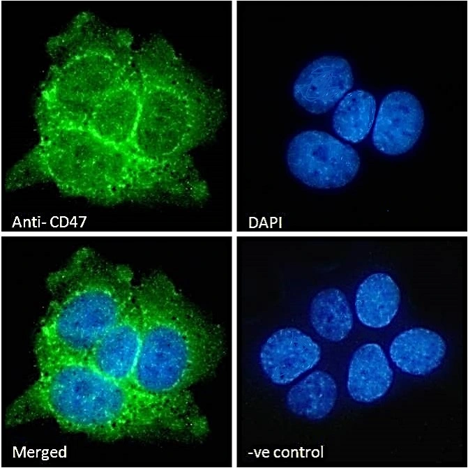 ICC/IF analysis of PFA-fixed A431 cells using GTX04816 CD47 antibody. Green : Primary antibody Blue : DAPI Ve-control : Unimmunized goat IgG Permeabilization : 0.15% Triton X-100 Dilution : 10 microg/ml