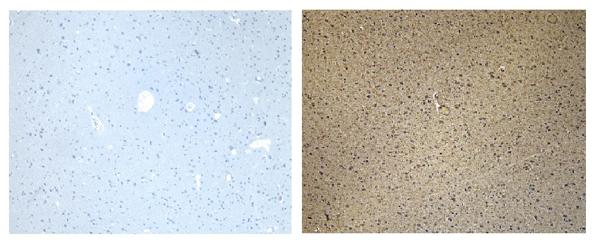IHC-P analysis of human cortex tissue using GTX04816 CD47 antibody. Right : Primary antibody Left : No primary antibody Antigen retrieval : Heat mediated citrate buffer (pH 6) Dilution : 7microg/ml