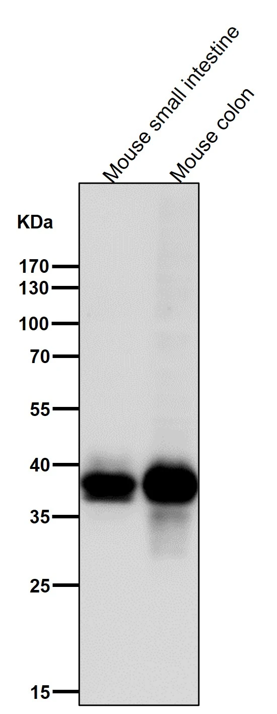 WB analysis of various samples using GTX04824 CDX2 antibody [AFA-3]. Dilution : 1:3000