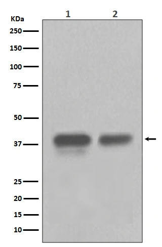 WB analysis of various samples using GTX04824 CDX2 antibody [AFA-3]. Lane 1 : HEK-293T whole cell lysate Lane 2 : human colon cancer tissue lysate
