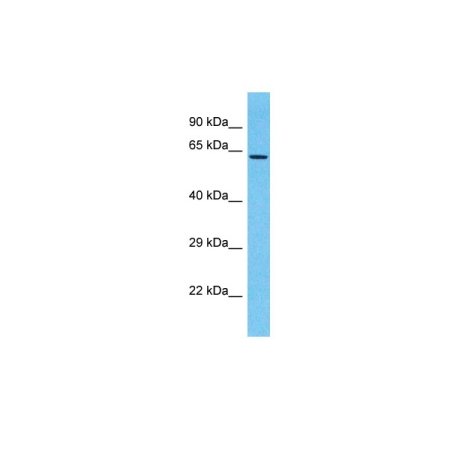 WB analysis of 721-B whole cell lysate using GTX04827 LRRC15 antibody. Dilution : 1 microg/ml