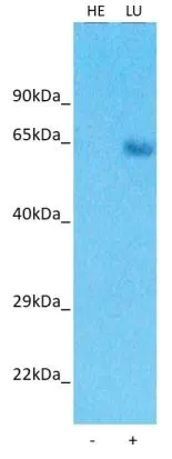 WB analysis of various samples using GTX04827 LRRC15 antibody. Human Fetal Heart (HE) tissue lysate, as positive control LU : Human Lung tissue lysate Loading : 25 microg Dilution : 3 microg/ml