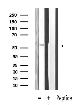 WB analysis of HeLa whole cell lysate using GTX04845 MMP13 antibody. The lane on the right was treated with blocking peptide.