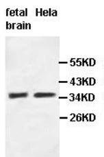 WB analysis of various samples using GTX04867 OPCML antibody. Lane 1 : human fetal brain tissue lysate Lane 2 : HeLa whole cell lysate Dilution : 1:500