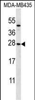 WB analysis of MDA-MB-435 whole cell lysate using GTX04877 KLRC1 antibody. Loading : 35 microg