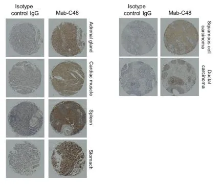 IHC-P analysis of human normal and tumor tissue arrays using GTX04888 CD317 antibody [C48]. Dilution : 1 microg /ml