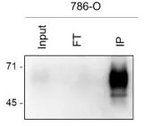 IP analysis of 786-O whole cell lysate using GTX04888 CD317 antibody [C48] IP antibody amount : 50 microL in 1 mL of RIPA buffer from 1 x 10? cells.
