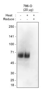WB analysis of 786-O whole cell lysate using GTX04888 CD317 antibody [C48]. Loading : 20 microg Dilution : 1:1000