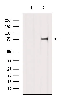 WB analysis of rat brain tissue lysate using GTX04905 GAS2L1 antibody. The lane on the left was treated with blocking peptide.