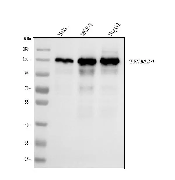 WB analysis of various samples using GTX04912 TIF1 alpha antibody [4G6C2]. Loading : 30microg Dilution : 0.5 microg/ml