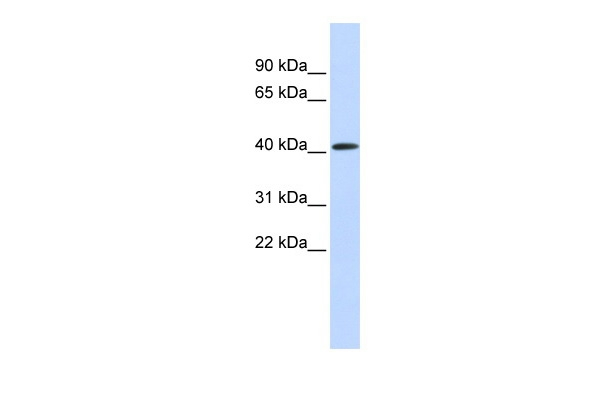WB analysis of human muscle tissue lysate using GTX04915 PARP11 antibody. WB analysis of human muscle tissue lysate using GTX04915 PARP11 antibody.