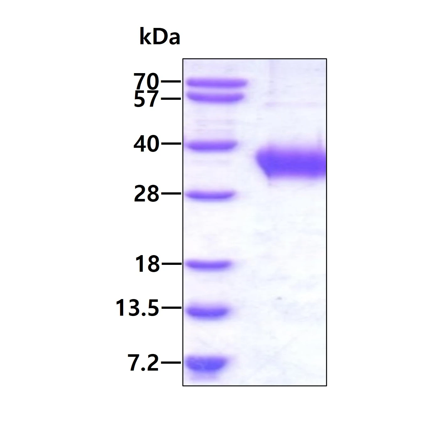 SDS-PAGE of GTX04921-pro Human CD16a (ECD) protein, His tag. Loading : 3 microg