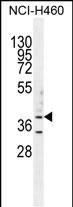 WB analysis of H460 whole cell lysate using GTX04927 B3GALT5 antibody. Loading : 35microg