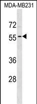 WB analysis of MDA-MB-231 whole cell lysate using GTX04932 ADAT1 antibody. Loading : 35 microg WB analysis of MDA-MB-231 whole cell lysate using GTX04932 ADAT1 antibody. Loading : 35 microg