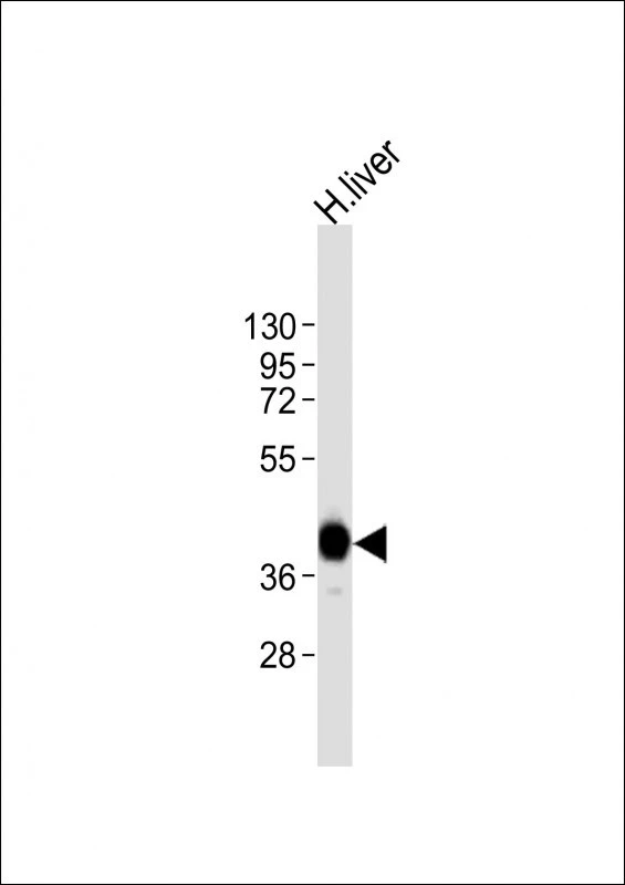 WB analysis of human liver tissue lysate using GTX04936 AGXT antibody. Loading : 20microg Dilution : 1:8000