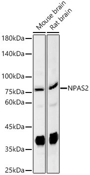WB analysis of various samples using GTX04938 NPAS2 antibody. Loading : 25microg Dilution : 1:400
