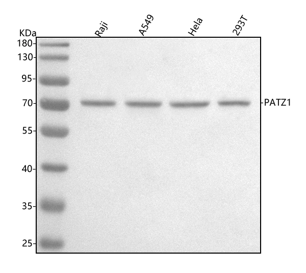 WB analysis of various samples using GTX04950 PATZ1 antibody. Loading : 30microg Dilution : 0.5 microg/mL